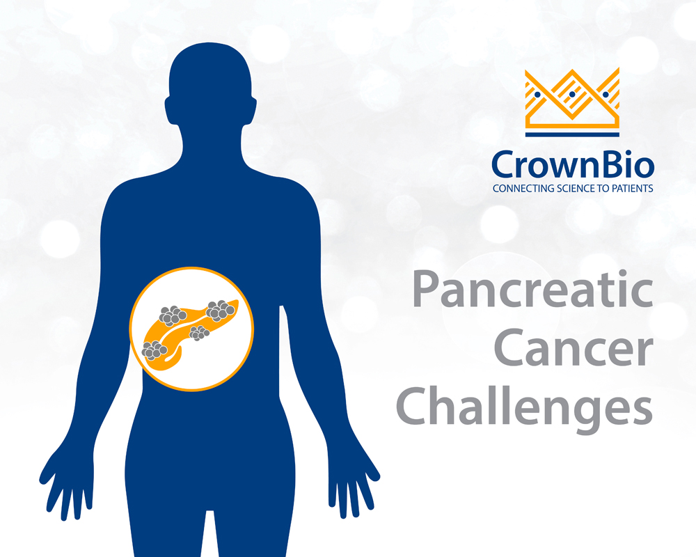 胰腺癌研究中的挑战与机遇