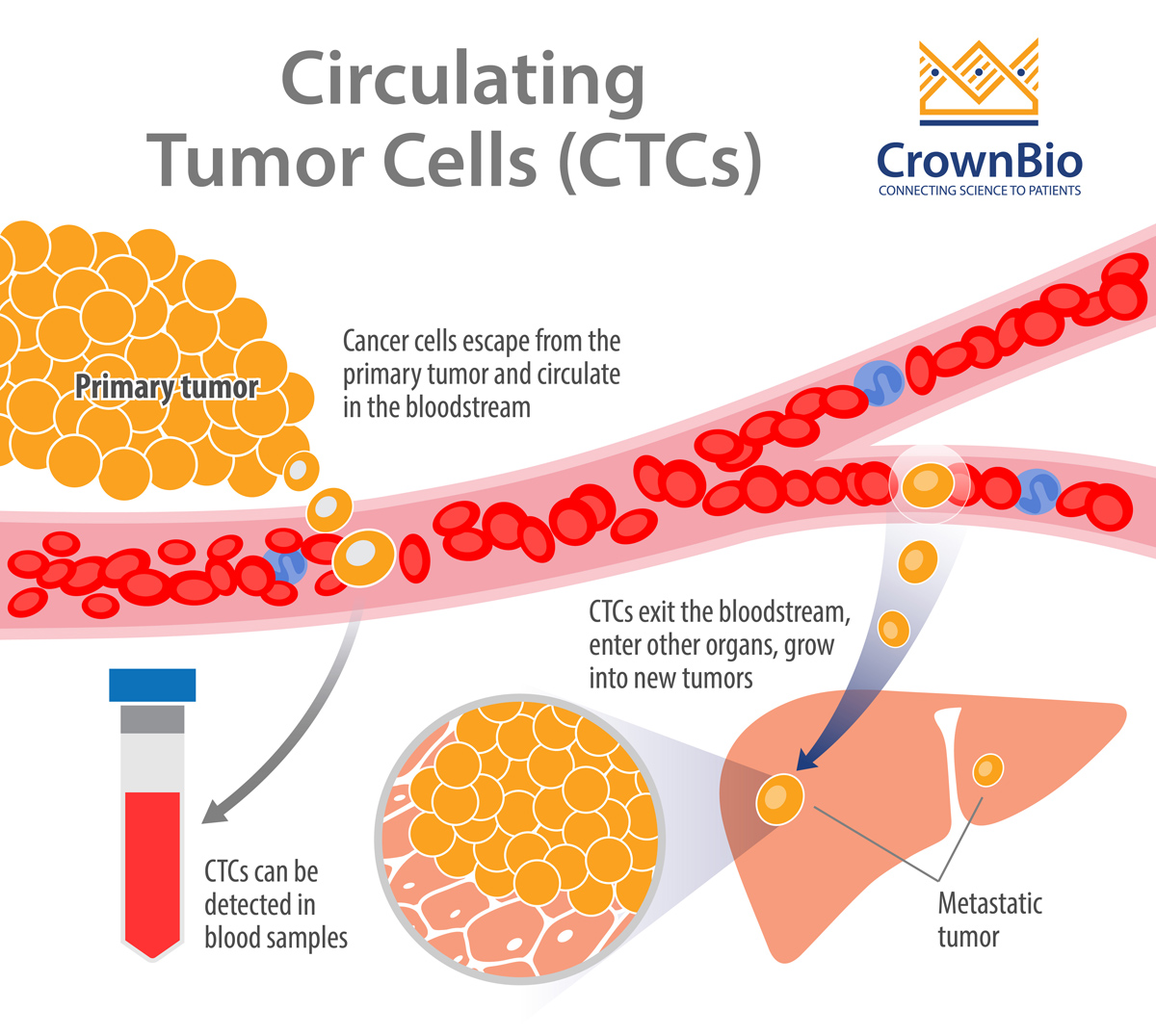 临床前转移小鼠模型中的循环肿瘤细胞