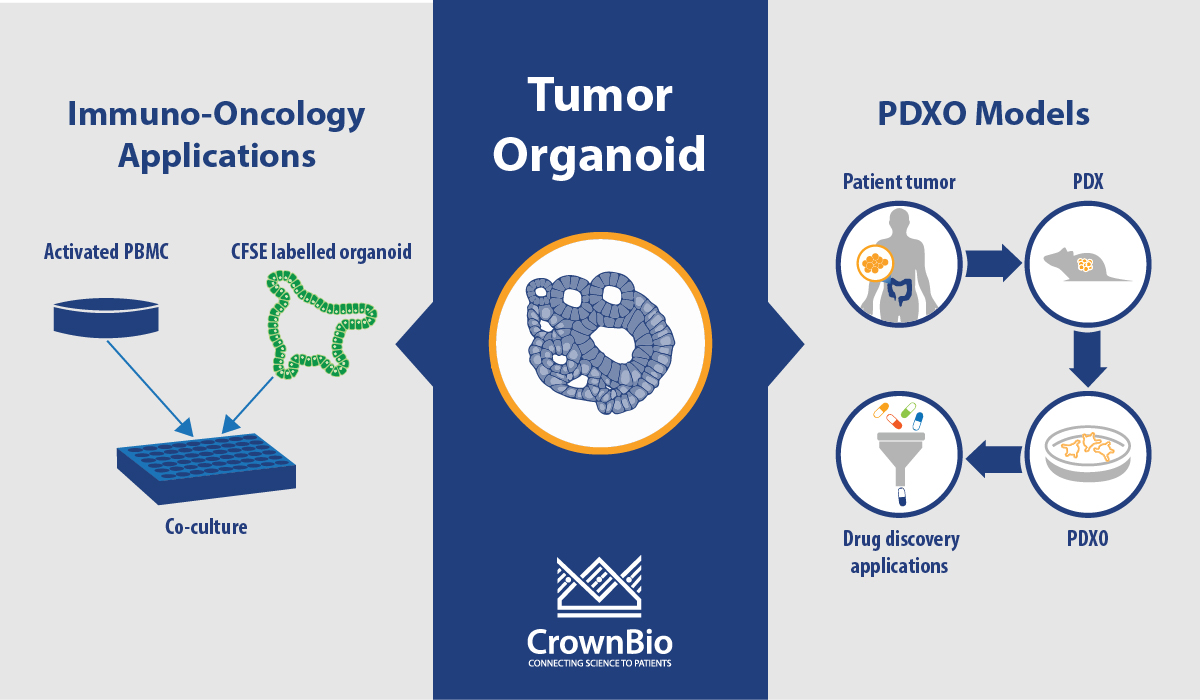 肿瘤类器官问答：PDXO模型和免疫肿瘤学应用